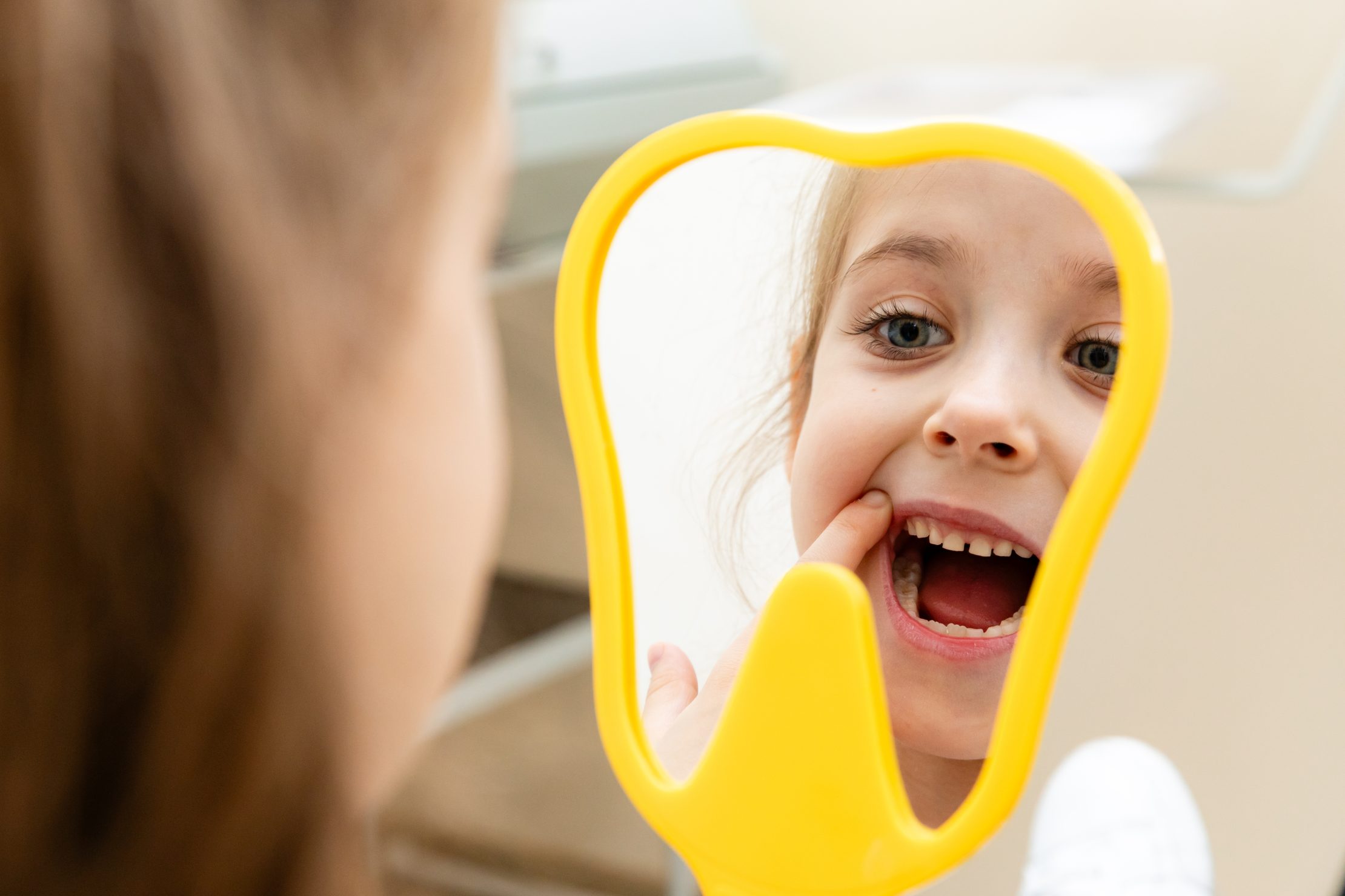 Fluoride Treatment